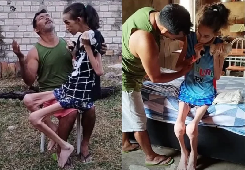 Ela perdeu os movimentos. Ele perdeu a vida que conhecia. Ma