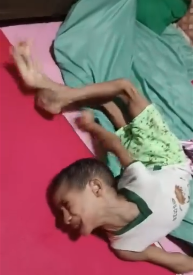 🚨 URGENTE: Luan, de 9 anos, sofre com uma doença rara que causa dores intensas e espasmos que estão deformando seu corpo.