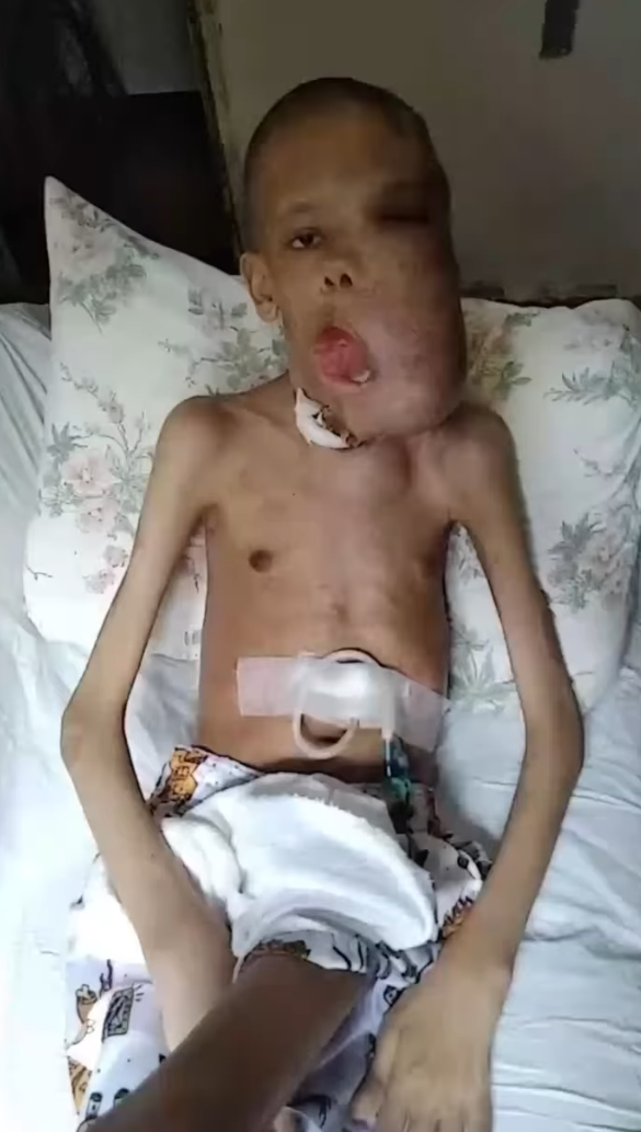 🚨 URGENTE: Erick tem tumores na cabeça que já chegam a pesar 6kg e precisa de ajuda imediata.