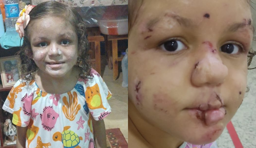 Ela tem só 8 anos… e pode perder muito mais que a infância: ajude Julinha a sobreviver a essa dor antes que seja tarde demais