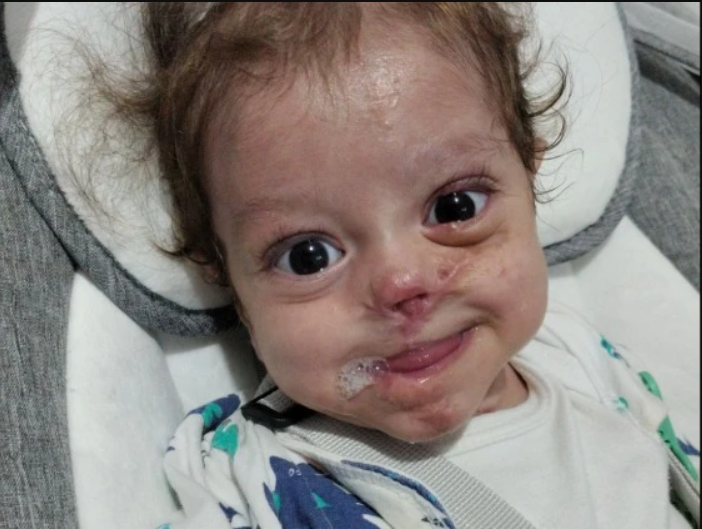 Ajude o Ravi, um bebê cardiopata